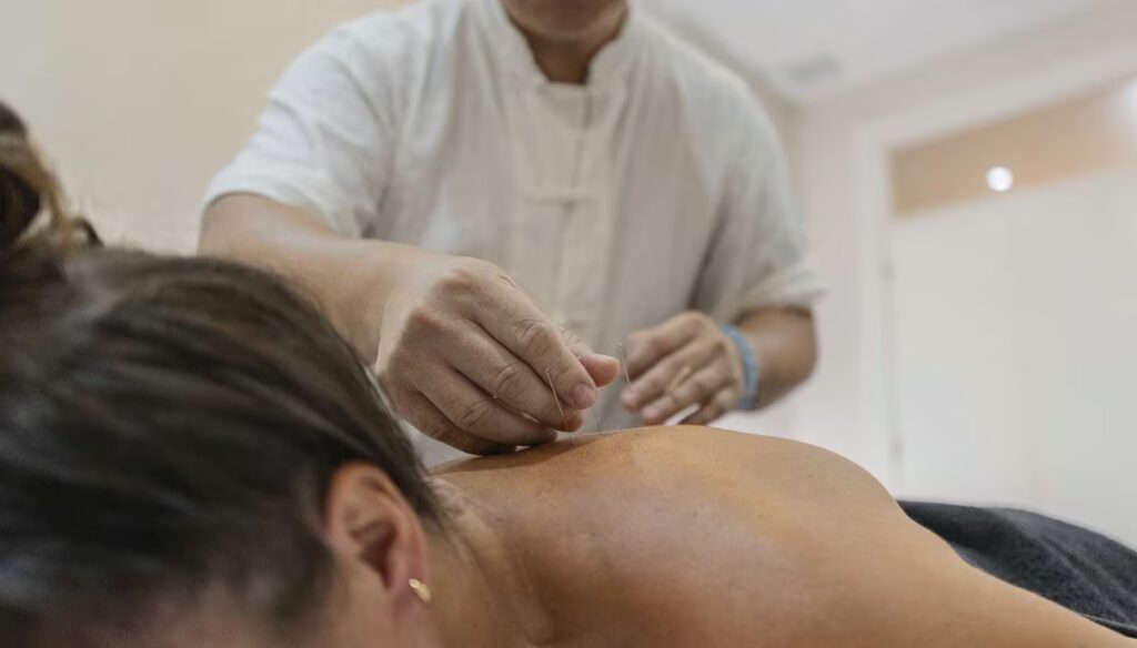 acupuncturist applying needles to woman s back for 2025 10 06 19 03 07 utc