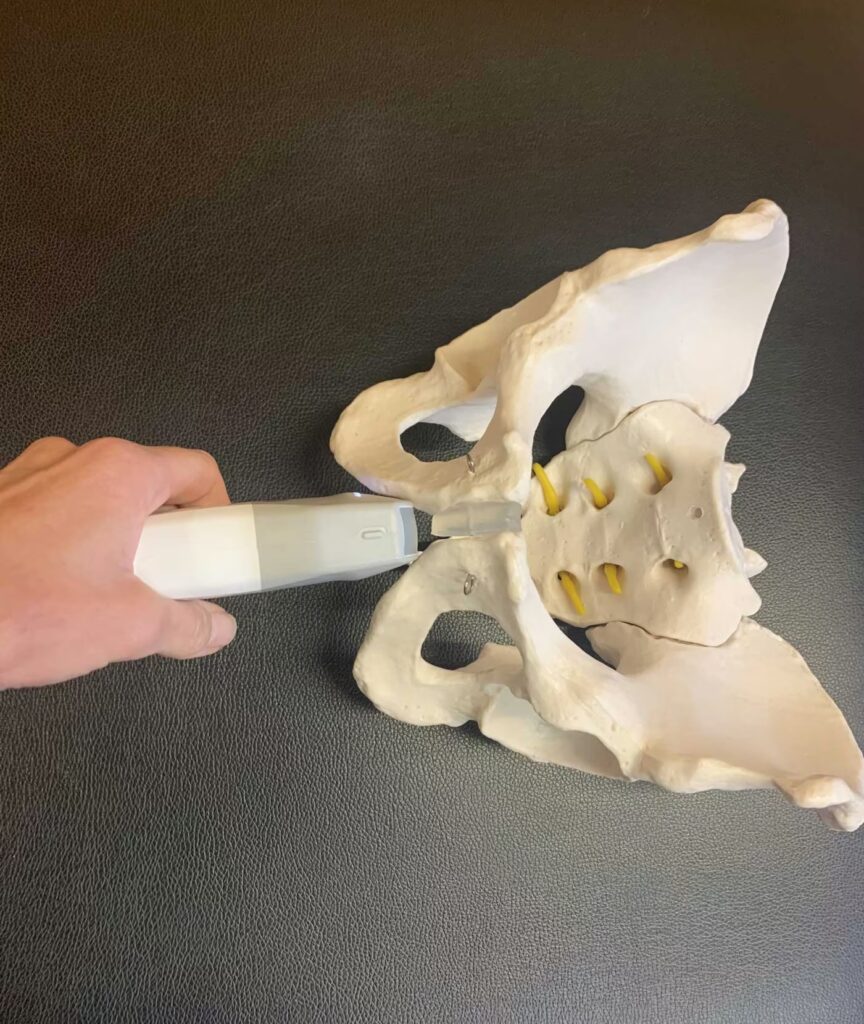Copy of Ultrasound position for pelvic floor
