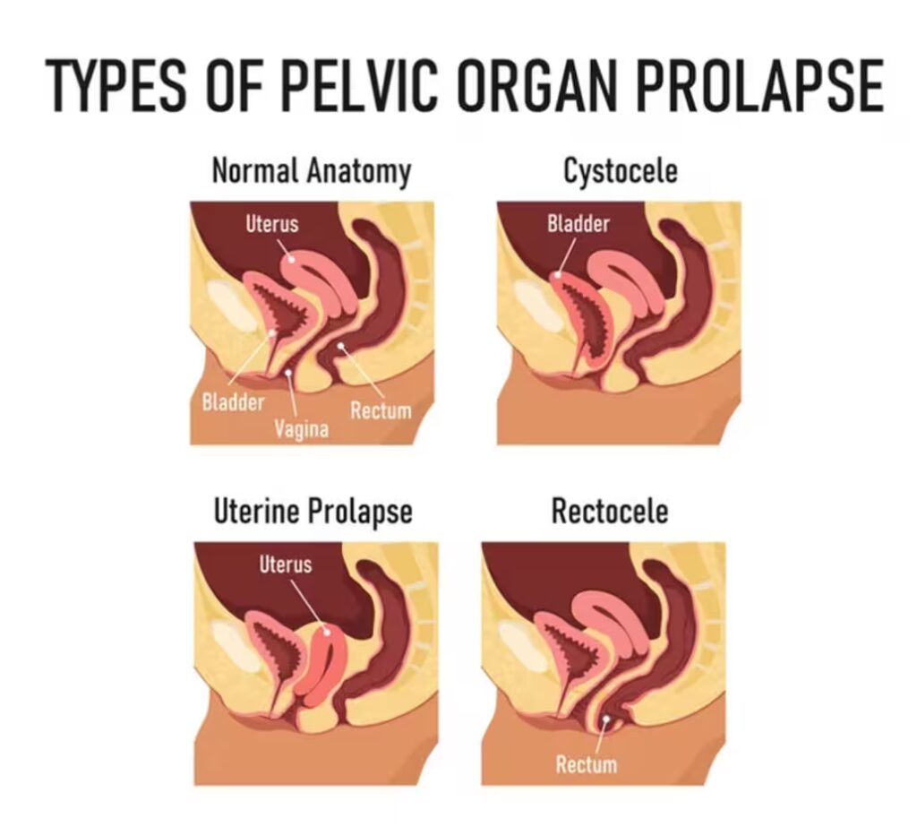 IMG 6272 converted 1